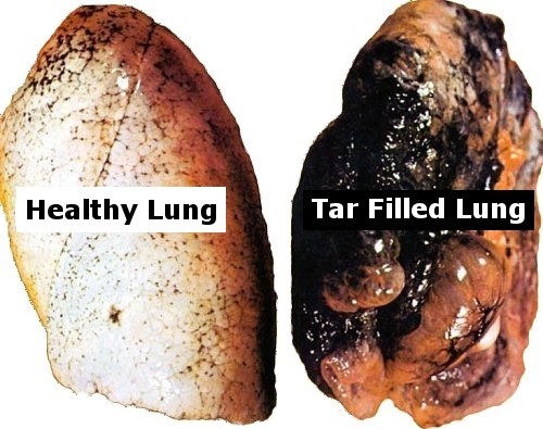 Marijuana And Your Lungs
